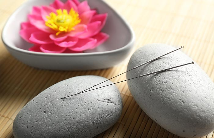 How To Treat Cubital Tunnel Syndrome