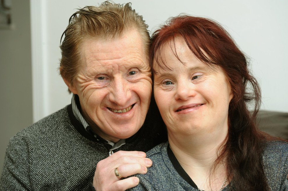 Couple With Down Syndrome