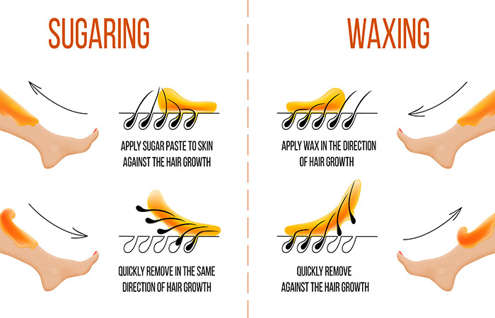  Sugaring And Waxing The Application Procedure