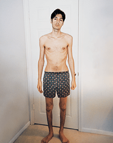 Jordan Rubin with Crohn's