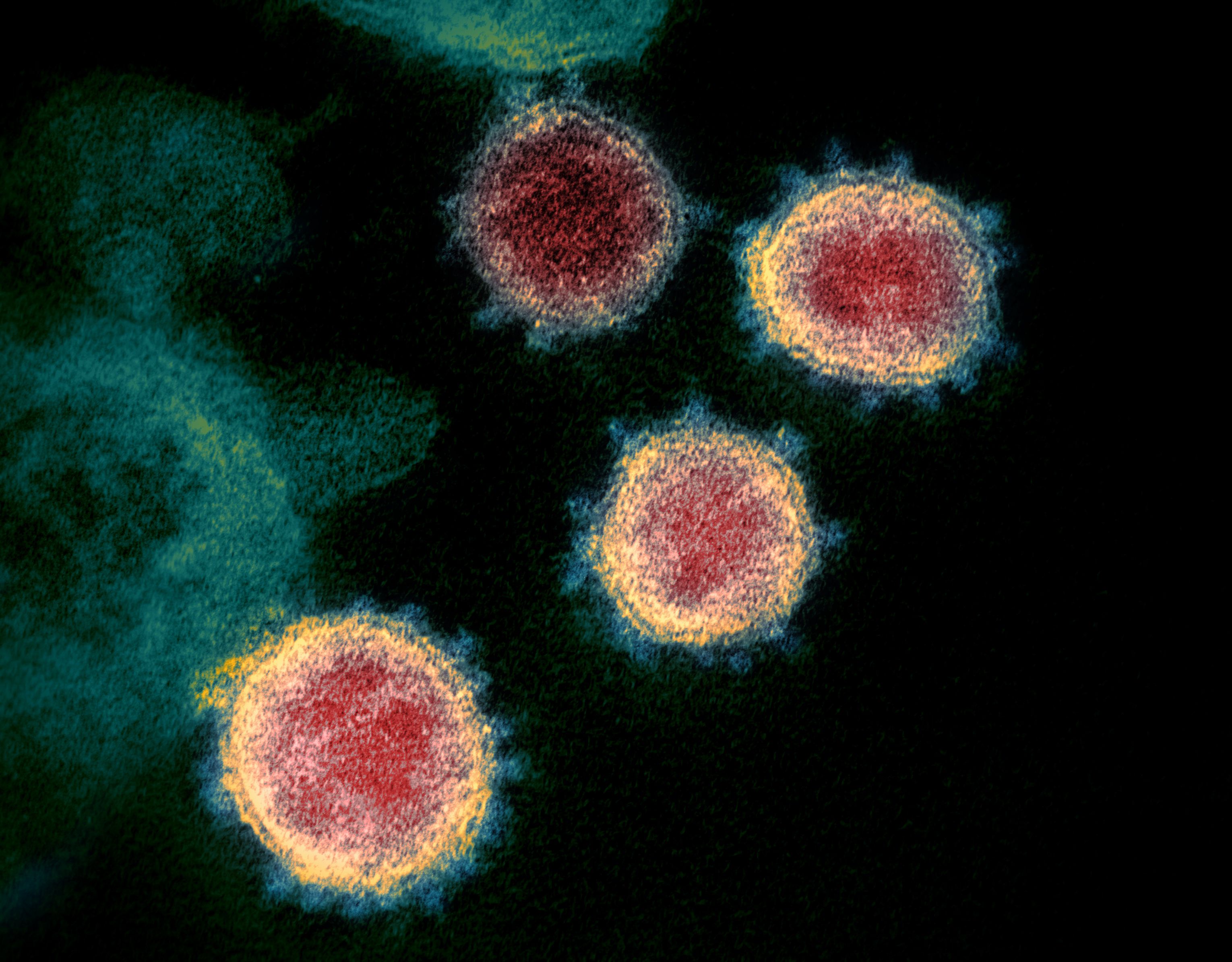 Having more sequenced samples of SARS-CoV-2 will help epidemiologists and others in the public health field better understand the profile of different strains of SARS-CoV-2, and track their spread.