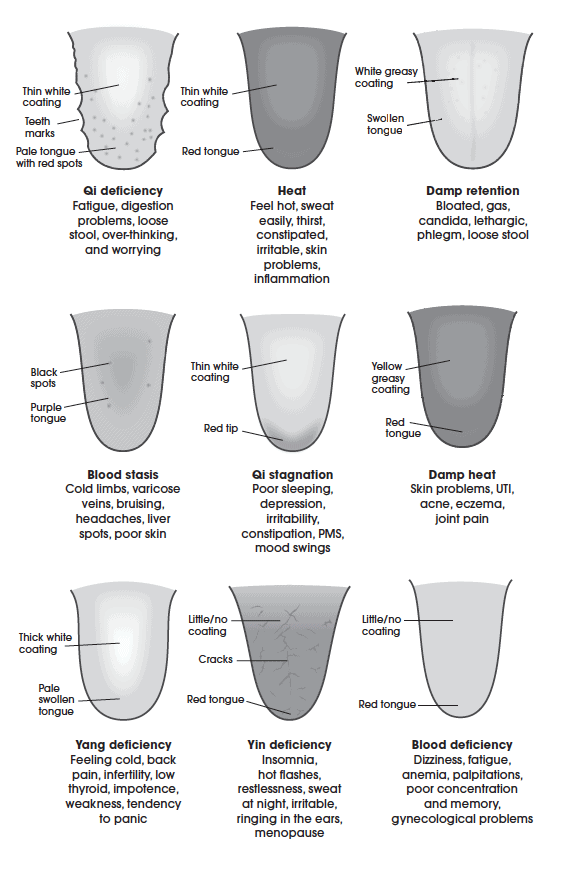 Tongue diagnosis TCM